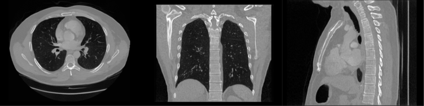 These images were produced as part of exploratory research into synthetic medical imaging and do not represent finalized outputs or validated clinical use cases.